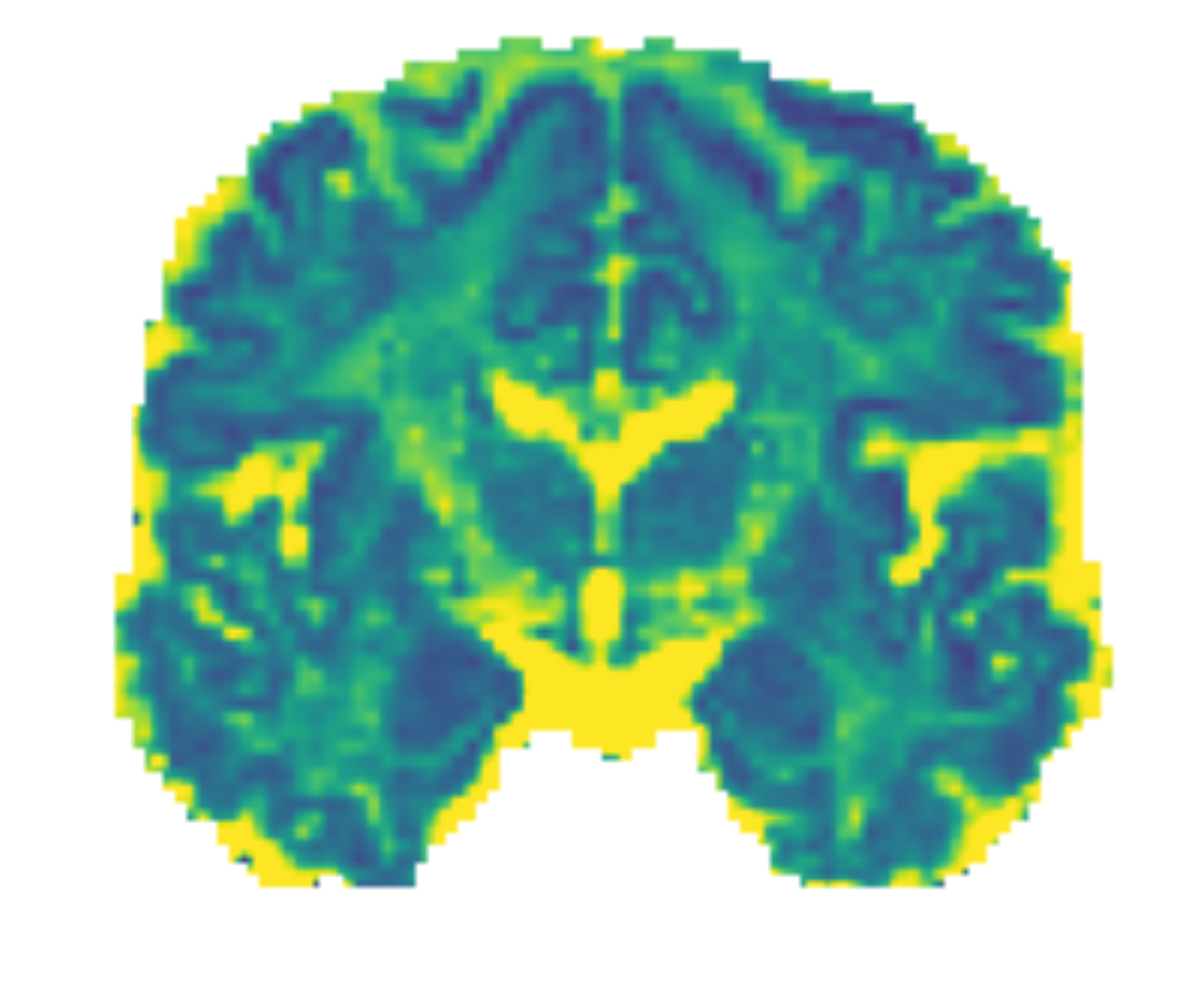 dMRI_diffusivity